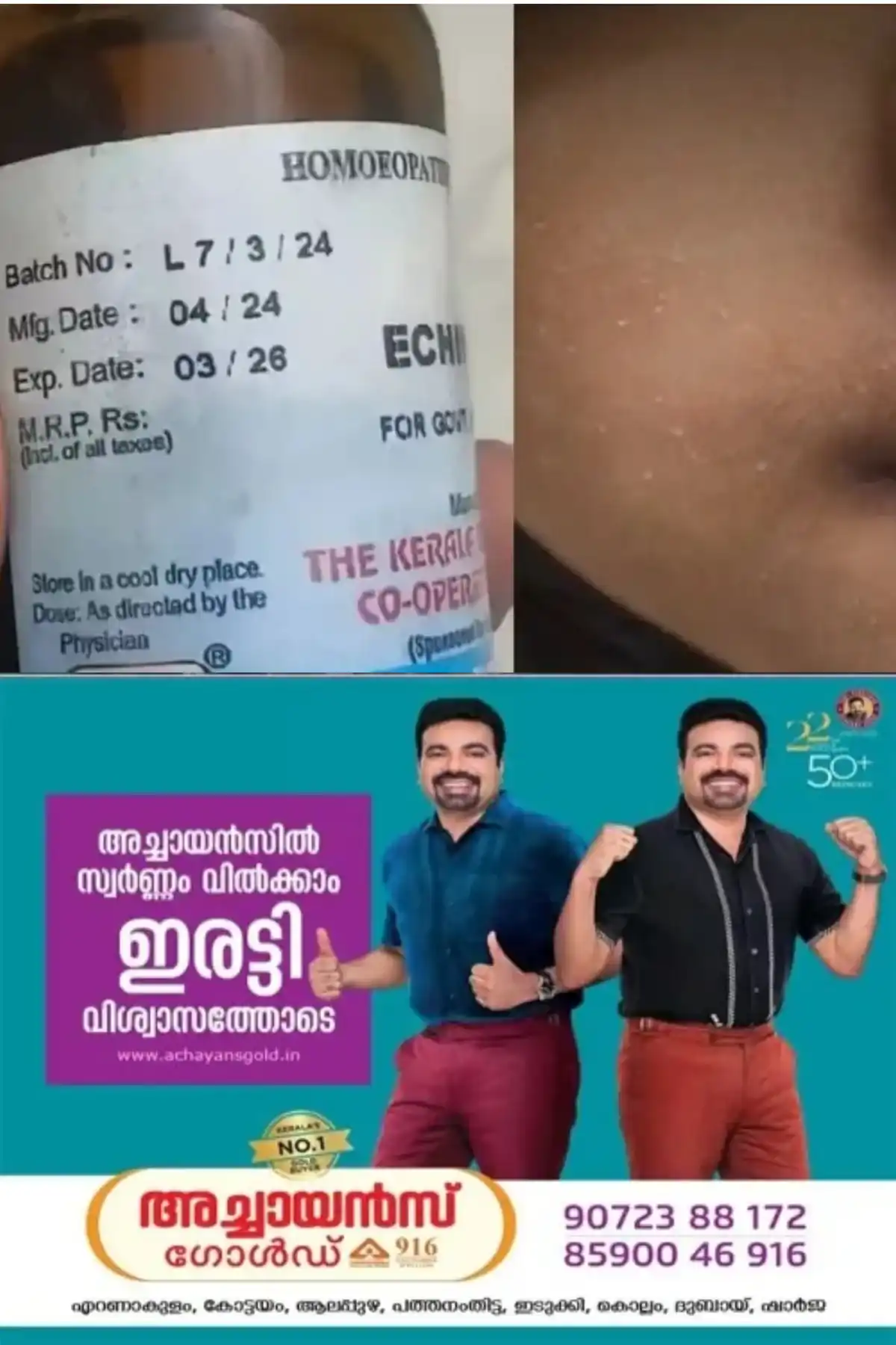ആറ്റിങ്ങല്‍ സർക്കാർ ഹോമിയോ ആശുപത്രിയില്‍ നാല് വയസുകാരിക്ക് കാലാവധി കഴിഞ്ഞ മരുന്ന് നല്‍കി;  ഡോക്ടര്‍ക്കും നഴ്സിംഗ് അസിസ്റ്റന്‍റിനും സസ്പെൻഷൻ