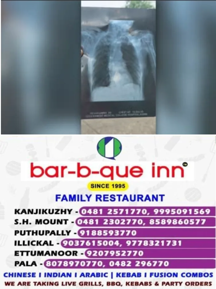 കോന്നി മെഡിക്കൽ കോളേജിൽ 16കാരിക്ക്  വയോധികയുടെ  എക്സ്റേ ഫിലിം  മാറി നൽകി;ചികിത്സാ പിഴവ്: സ്വമേധയാ കേസെടുത്ത് ബാലാവകാശ കമ്മീഷൻ
