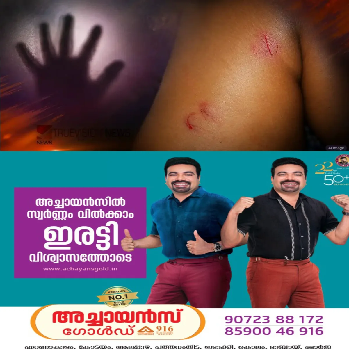 മോഷണം ആരോപിച്ച്  പന്ത്രണ്ടുകാരനെ ബന്ധുക്കള്‍ മർദ്ദിച്ച സംഭവത്തില്‍ പരാതി ഒഴിവാക്കാൻ ശ്രമം: പണമോ സൈക്കിളോ നൽകാമെന്ന പ്രതിയുടെ രബ്ദരേഖ പുറത്ത്.