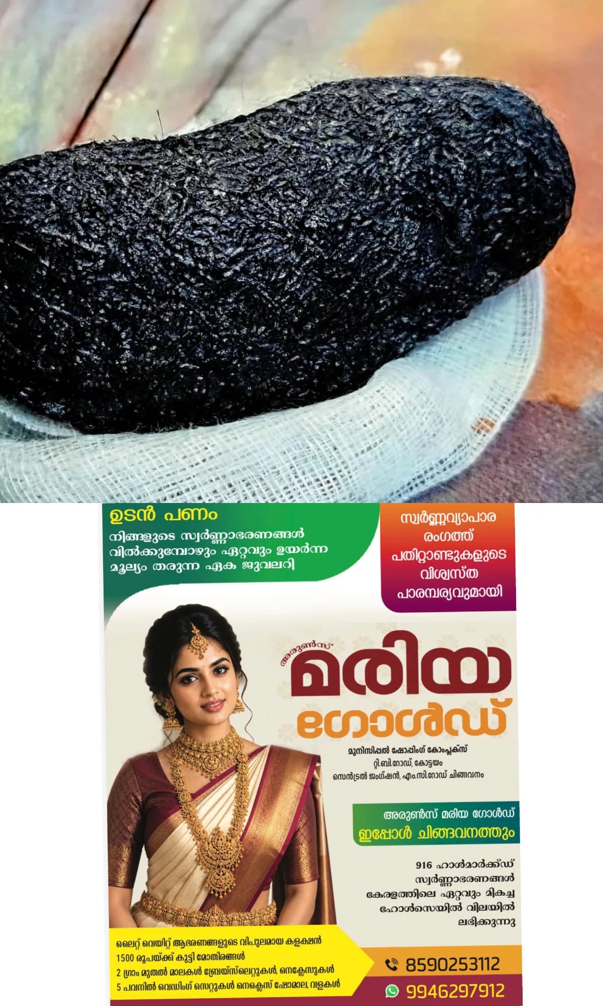 'തുടർച്ചയായി വയറു വേദനയും ഛർദിയും'; പരിശോധനയില്‍ ഒമ്പത് വയസ്സുകാരിയുടെ വയറ്റിൽ നിന്ന് പുറത്തെടുത്തത് ഒരു കിലോ തലമുടി, സംഭവം നെയ്യാറ്റിന്‍കരയിൽ
