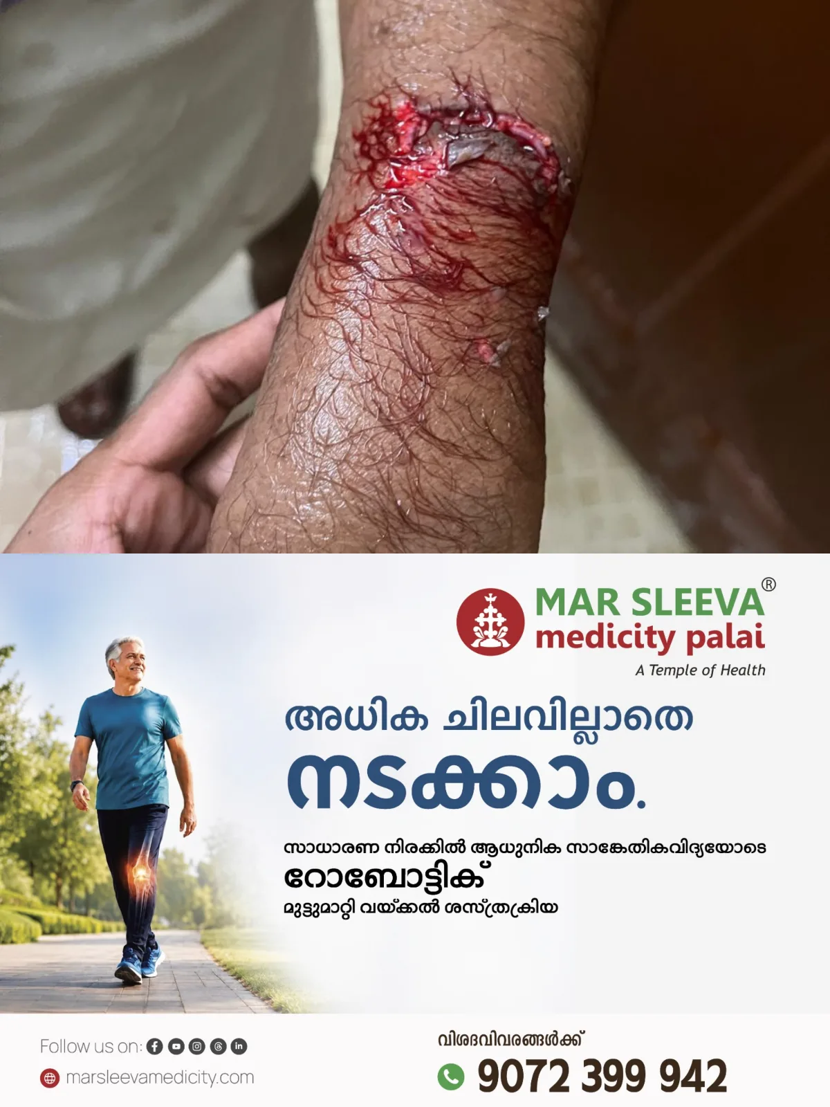 കോട്ടയത്ത്‌ തെരുവുനായ ഭീതി; കുടയംപടി ഭാഗത്ത് തെരുവുനായ ആക്രമണത്തിൽ പത്തു പേർക്ക് കടിയേറ്റു; പരുക്കേറ്റവരെ കോട്ടയം മെഡിക്കൽ കോളേജ് ആശുപത്രിയിൽ പ്രവേശിപ്പിച്ചു