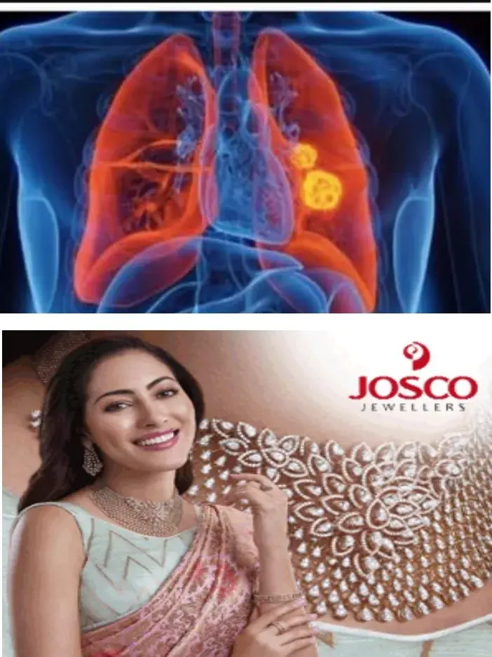 നിരന്തരമായ നെഞ്ചു വേദനയും ചുമയ്ക്കുമ്പോൾ രക്തം പുറത്ത് വരുന്നതും ഒരിക്കലും അവഗണിക്കരുത്