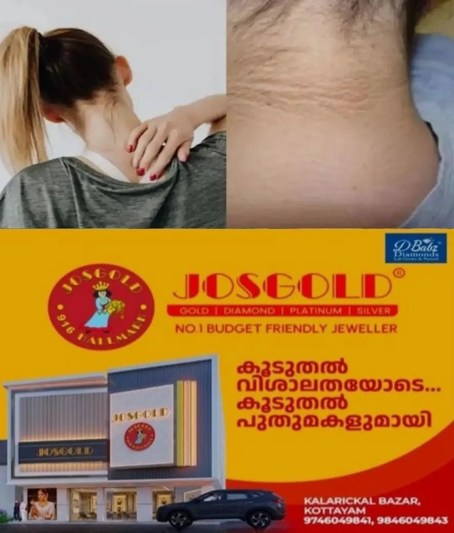 എത്ര ശ്രമിച്ചിട്ടും കഴുത്തിലെ കറുപ്പ് നിറം മാറുന്നില്ലേ? എങ്കില് ഇതൊന്ന് പരീക്ഷിക്കൂ; ഫലം ഉറപ്പ്...