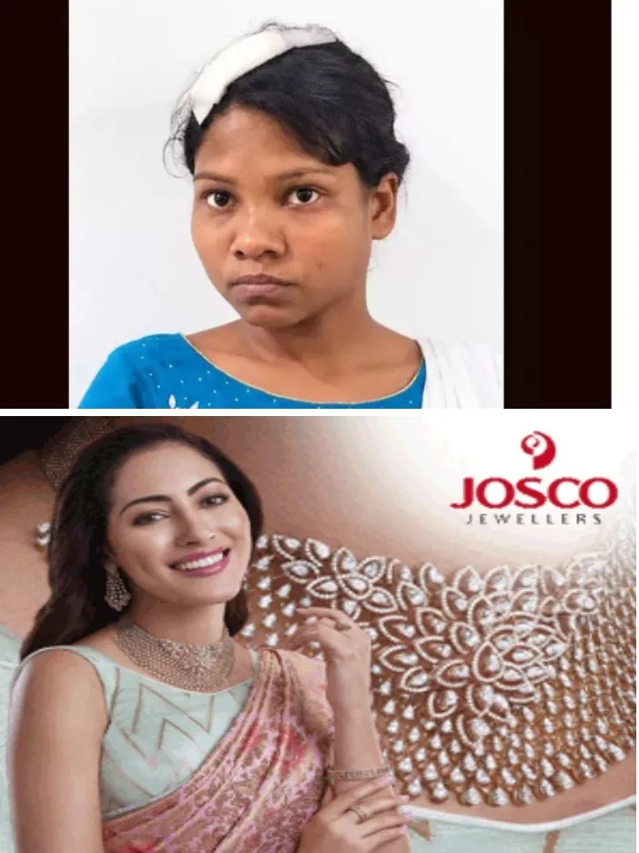 ആറളത്ത് മദ്യപിച്ച് ബഹളമുണ്ടാക്കിയത് ചോദ്യം ചെയ്ത അയല്വാസിയെ വെട്ടിപ്പരിക്കേല്പ്പിച്ച് യുവതി; മൂക്കിനും ഞരമ്പുകള്ക്കും ഗുരുതര പരിക്ക്; 29കാരി റിമാന്ഡില്