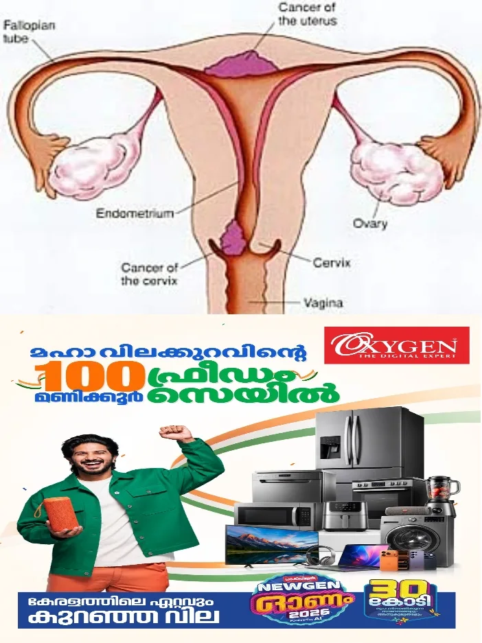 ആര്ത്തവമില്ലാത്ത സമയങ്ങളില് രക്തസ്രാവം,ലൈംഗിക ബന്ധത്തിന് ശേഷം രക്തം; ഈ ലക്ഷണങ്ങളെ നിസ്സാരവൽക്കരിക്കരുത്;.ഗര്ഭാശയമുഖ ക്യാന്സര്; തിരിച്ചറിയാതെ പോകുന്ന ലക്ഷണങ്ങള്