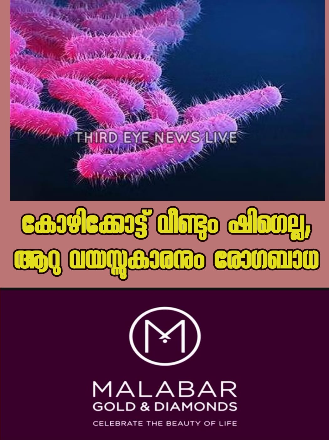 shigella