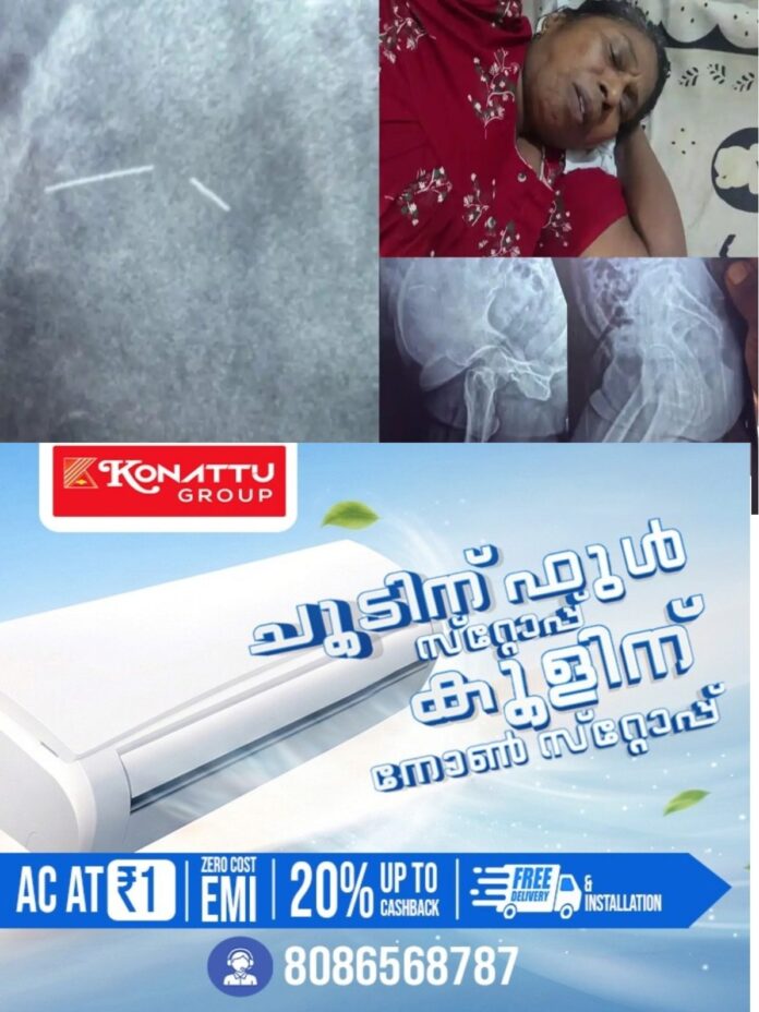 ei2AJKB35615